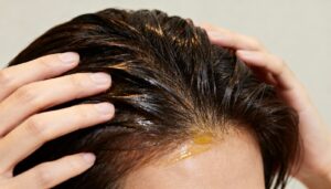 Why Your Scalp Itches After Hair Oil & How to Fix It
